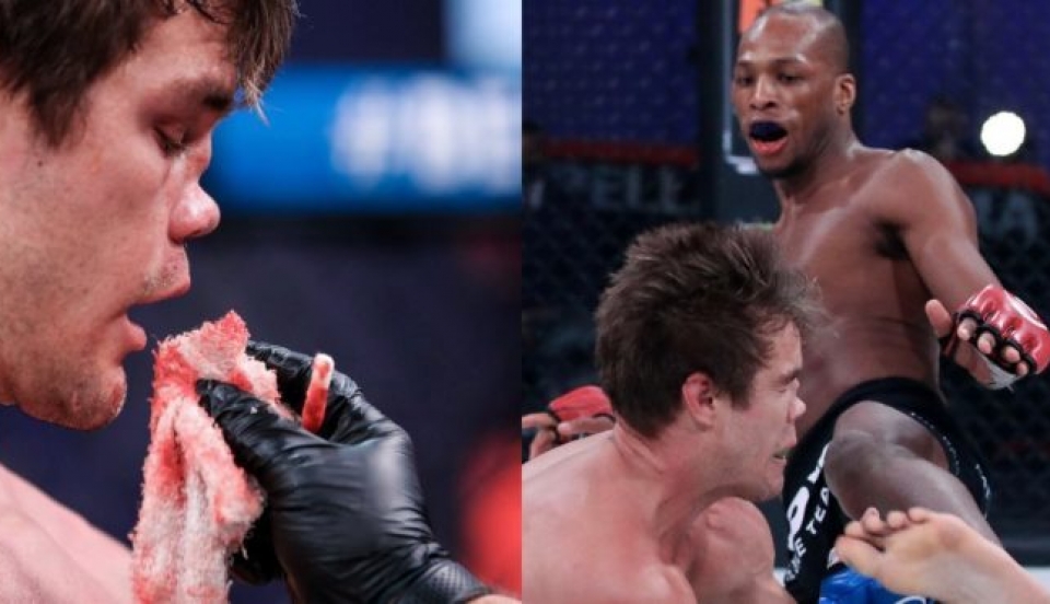 Limay Perú - Portal de Noticias de Lima Norte