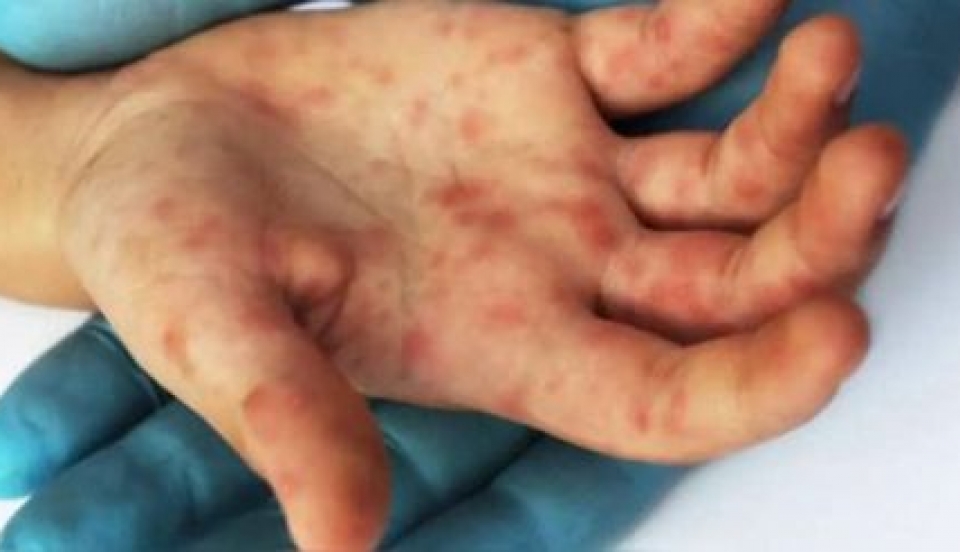 Limay Perú - Portal de Noticias de Lima Norte