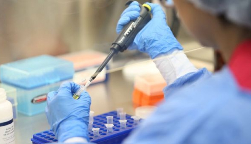 Limay Perú - Portal de Noticias de Lima Norte Limay Perú - Portal de Noticias de Lima Norte