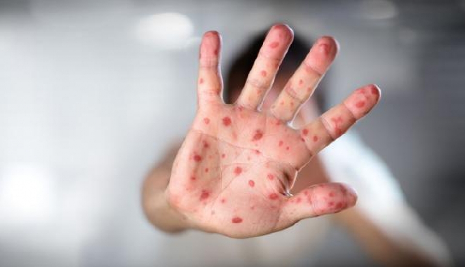 Limay Perú - Portal de Noticias de Lima Norte