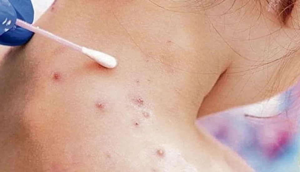 Limay Perú - Portal de Noticias de Lima Norte