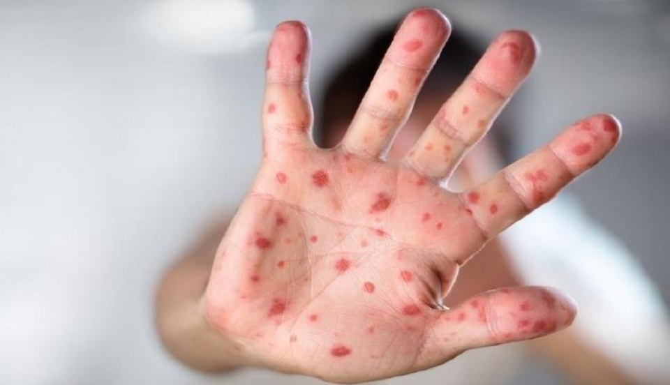 Limay Perú - Portal de Noticias de Lima Norte