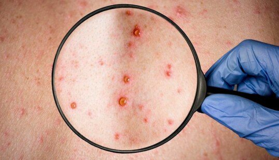 Limay Perú - Portal de Noticias de Lima Norte