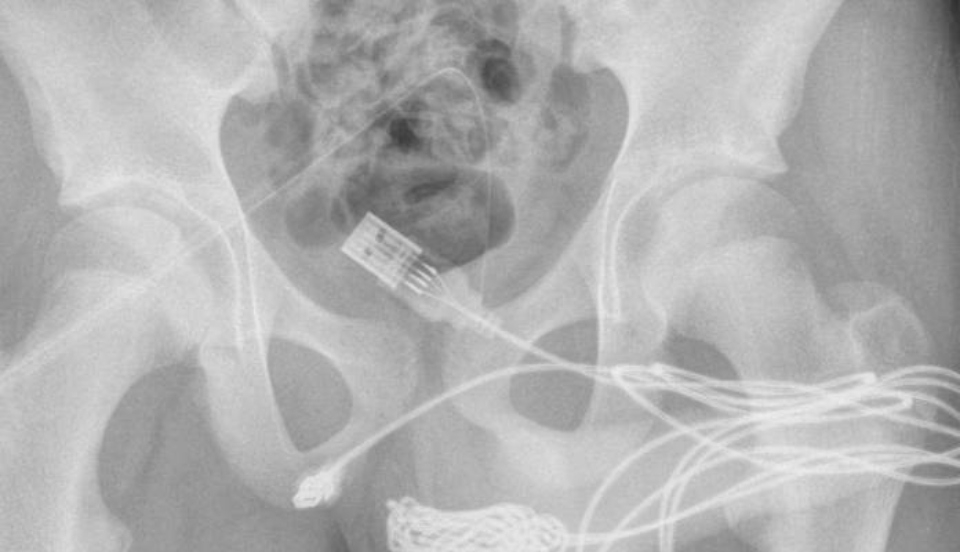 Limay Perú - Portal de Noticias de Lima Norte Limay Perú - Portal de Noticias de Lima Norte