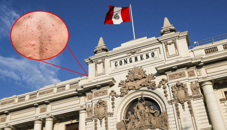 Limay Perú - Portal de Noticias de Lima Norte