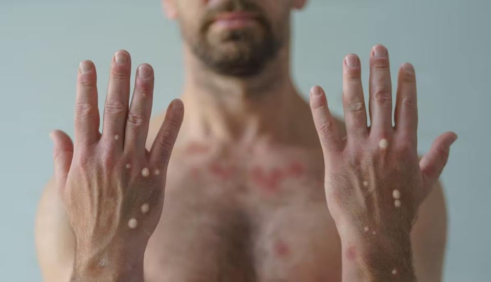 Limay Perú - Portal de Noticias de Lima Norte