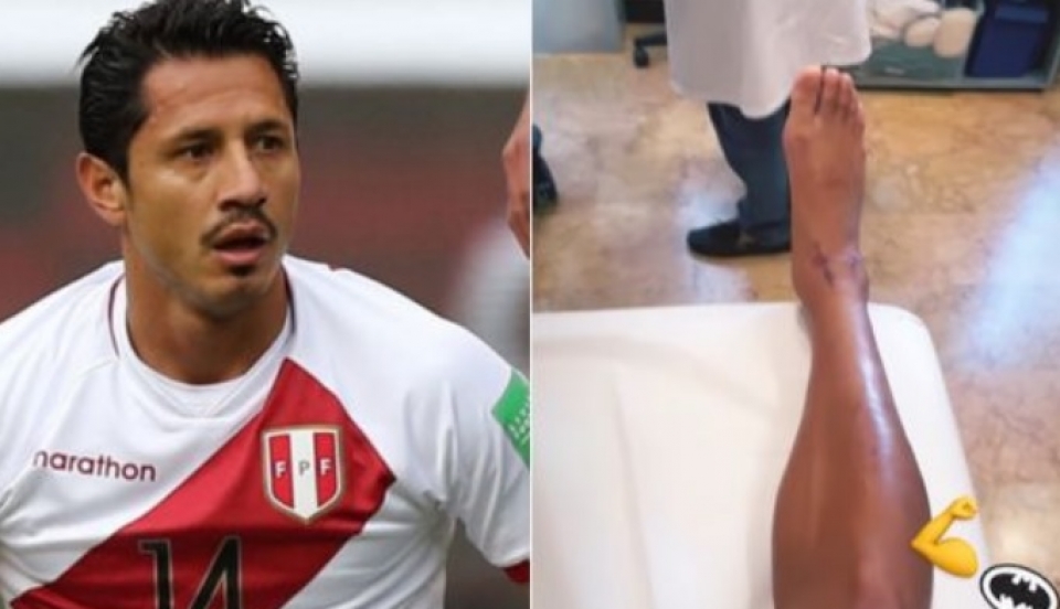 Limay Perú - Portal de Noticias de Lima Norte