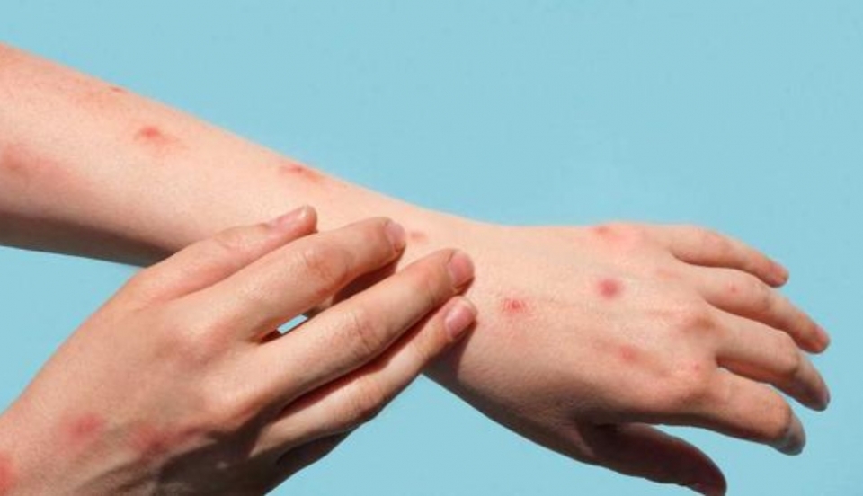 Limay Perú - Portal de Noticias de Lima Norte