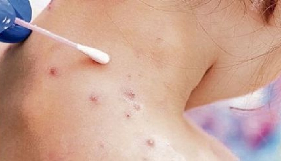 Limay Perú - Portal de Noticias de Lima Norte