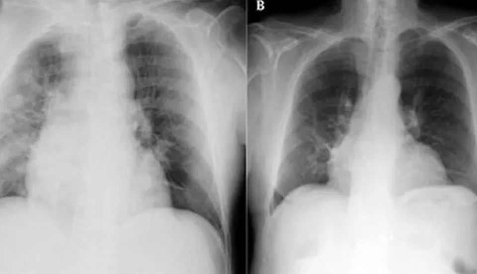 Limay Perú - Portal de Noticias de Lima Norte