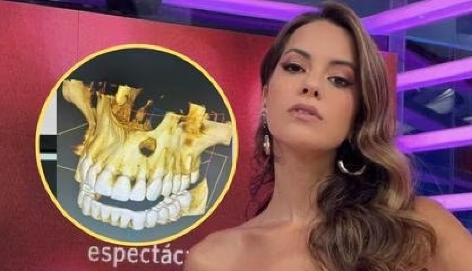 Limay Perú - Portal de Noticias de Lima Norte