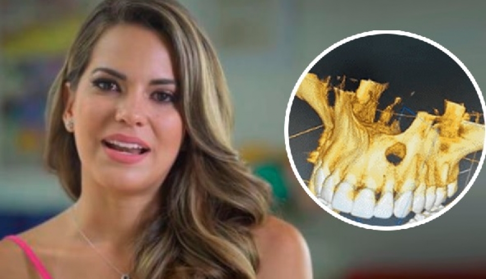 Limay Perú - Portal de Noticias de Lima Norte