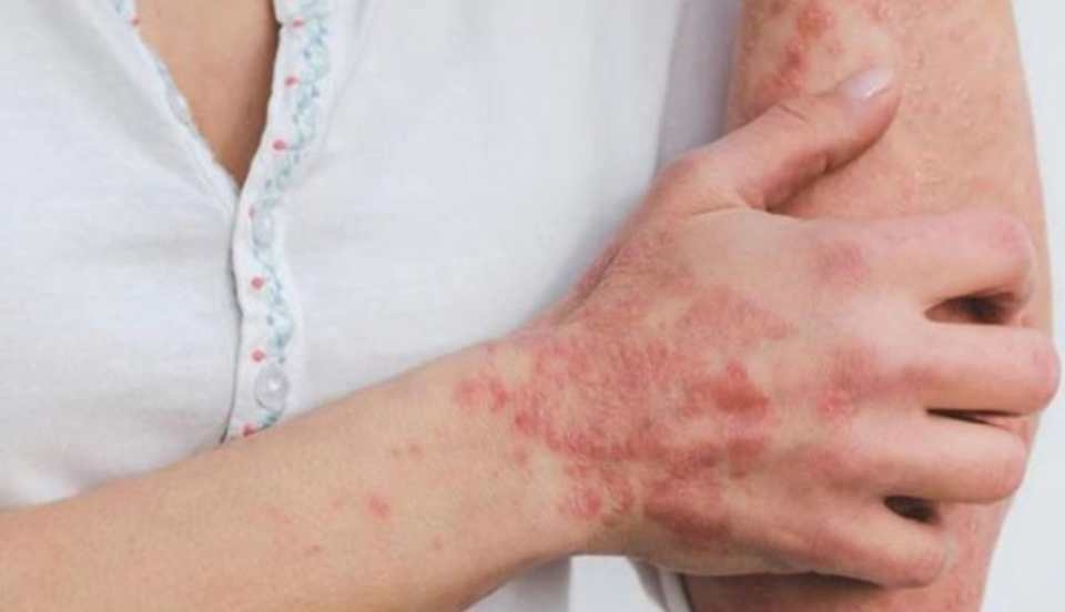 Limay Perú - Portal de Noticias de Lima Norte