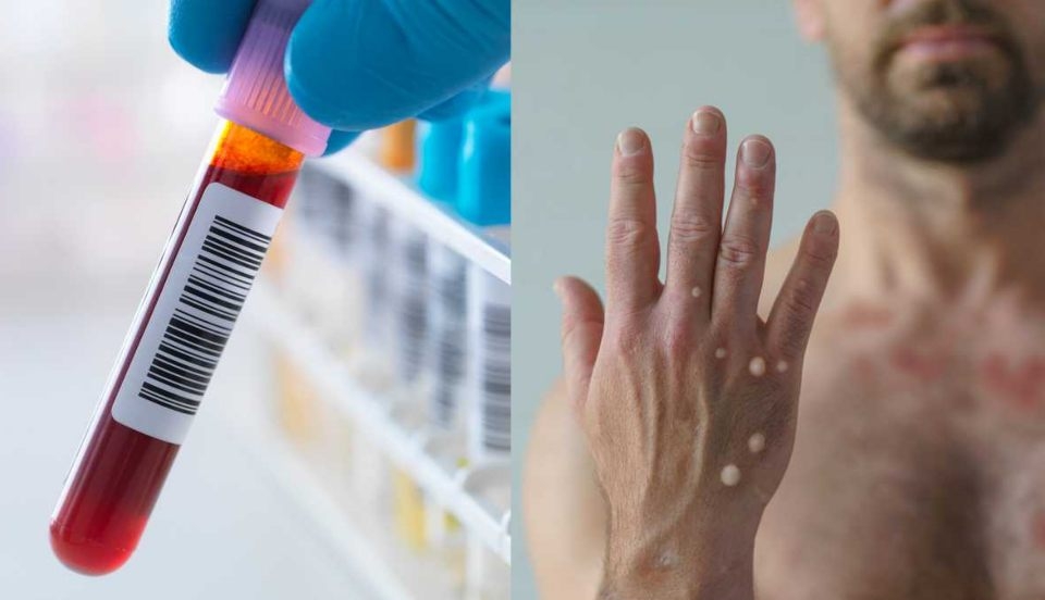 Limay Perú - Portal de Noticias de Lima Norte Limay Perú - Portal de Noticias de Lima Norte