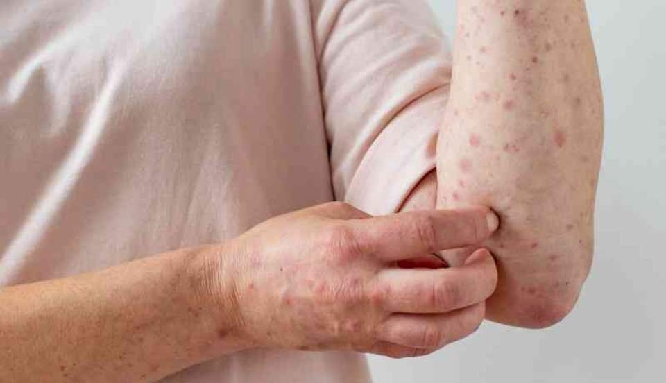 Limay Perú - Portal de Noticias de Lima Norte