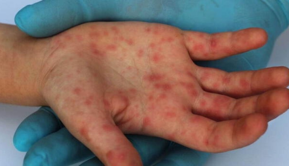 Limay Perú - Portal de Noticias de Lima Norte Limay Perú - Portal de Noticias de Lima Norte