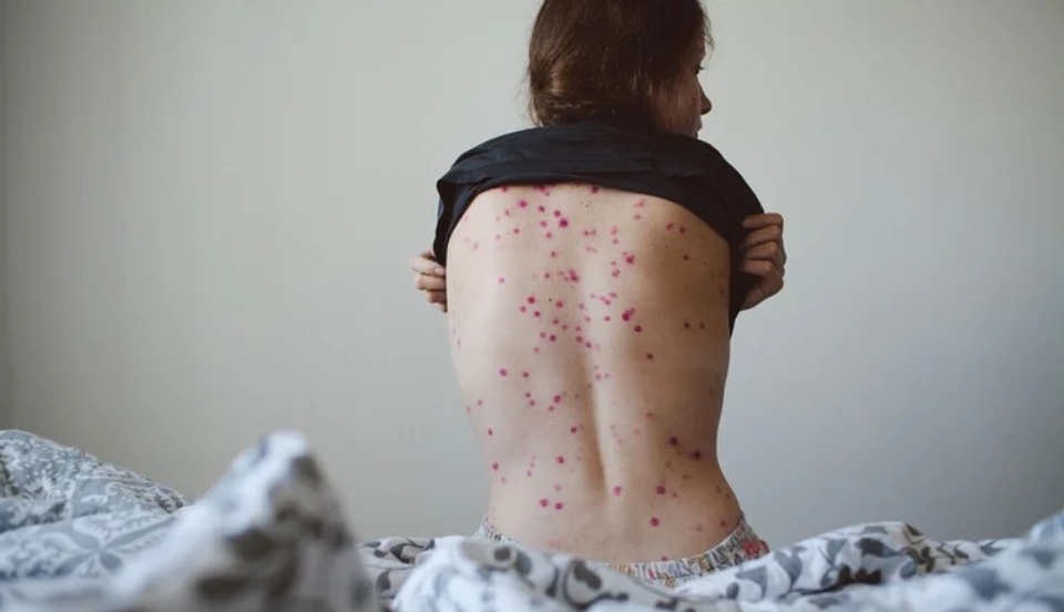 Limay Perú - Portal de Noticias de Lima Norte