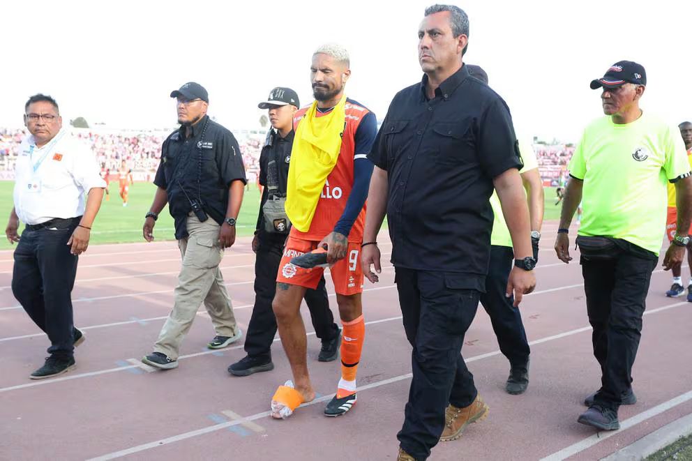 Paolo Guerrero salió lesionado durante el choque entre la Vallejo y Sport Boys 