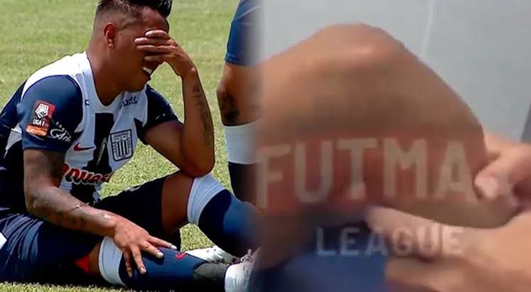¿Cuevita otra vez lesionado? ¿Participará de los partidos amistosos con Paraguay y Chile?