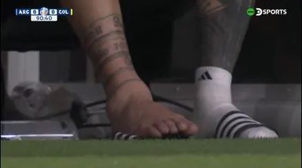 Mira cómo quedó el tobillo de Lionel Messi al  final de la Copa América 2024