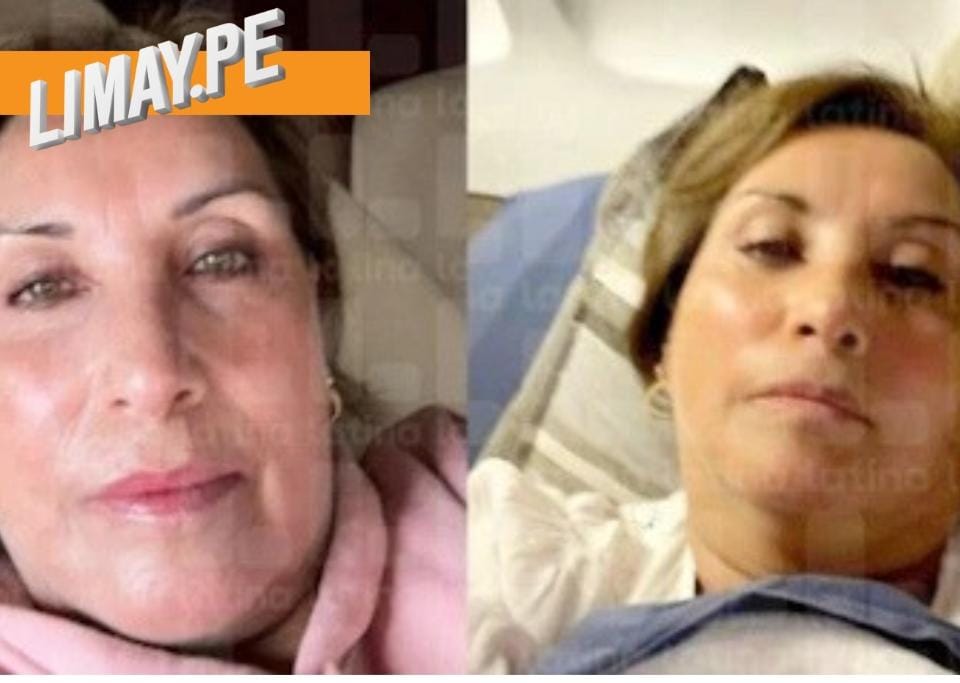 Boluarte bajo la lupa: hallazgos en su iPhone revelan cirugías