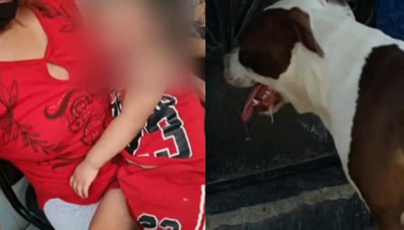 Menor de dos años queda desfigurada tras ser atacada por perro pitbull