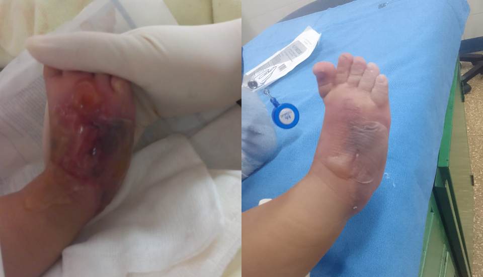 Padres de una menor de 7 meses denuncian negligencia médica en el Hospital Rebagliati
