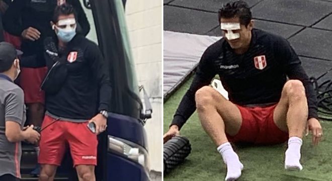 Selección peruana: Gianluca Lapadula jugará el Perú vs. Brasil con máscara especial